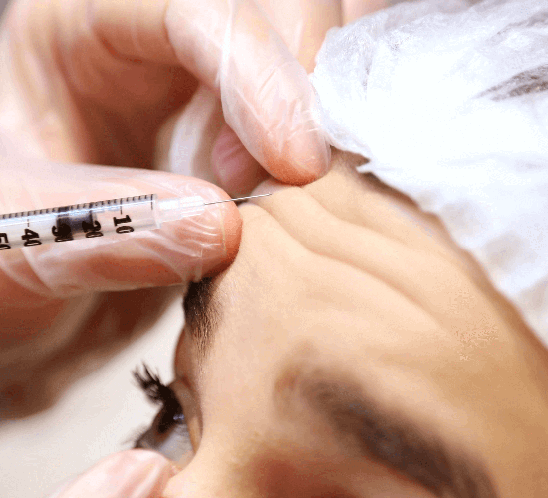 Treatment with injection for forehead wrinkles.